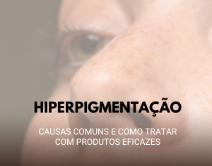 Hiperpigmentação: Causas Comuns e Como Tratar com Produtos Eficazes